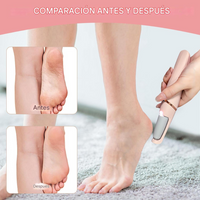 CleanFoot™ | Removedor de callos e impurezas 🌟