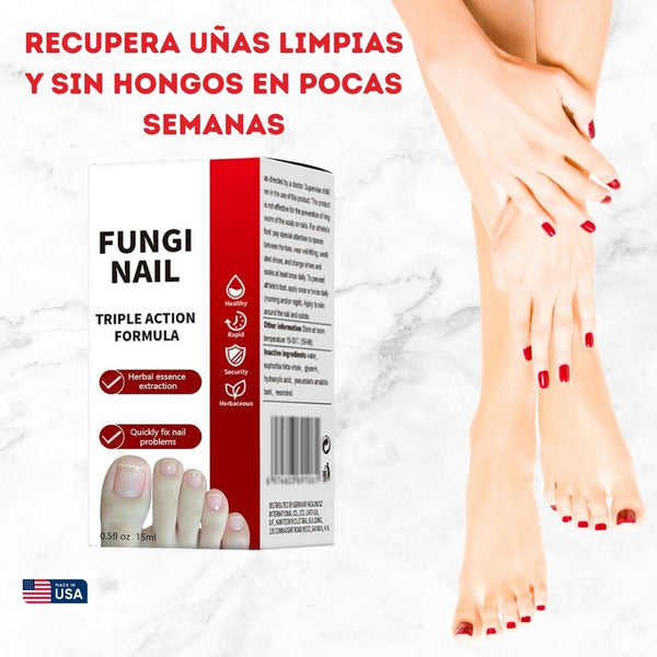 Fungi Nail | OFERTA 3x1 TRATAMIENTO DE HONGOS PARA LAS UÑAS