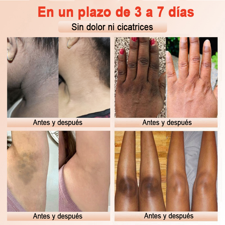 Jorondy™ | Gel Aclarante y despigmentante 🌟