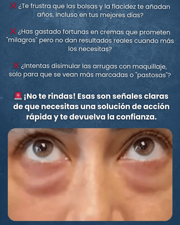 Celyn Eye Cream (lifting de ojos) estandar