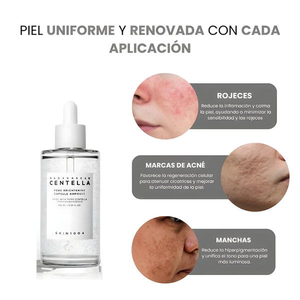 Centella Tone | Sérum antimanchas