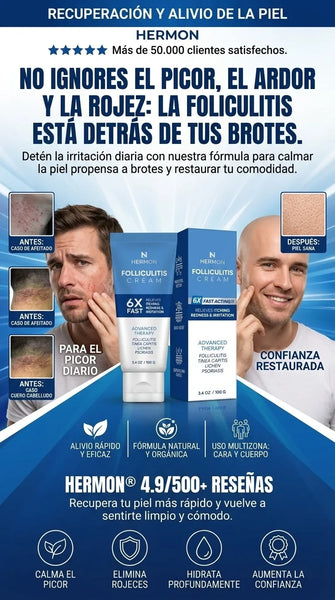 Foliculitis - cream